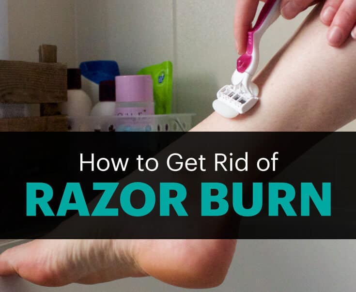 How to get rid of razor burn - RazorHere How to get rid of razor burn - RazorHere